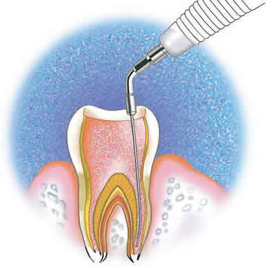 Implantar Clínica Odontológica